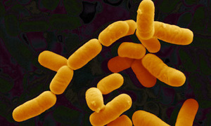 Lactobacillus_rhamnosus